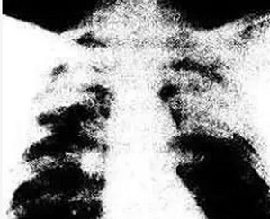 늺������I(y��)�������m�β�